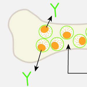 【多発性骨髄腫 体験談】多発性骨髄腫についてもっと知ってほしい