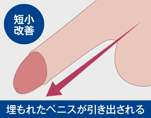 理想のペニスの大きさは!?経験人数や初体験 女のリアルSEX事情を調査 |