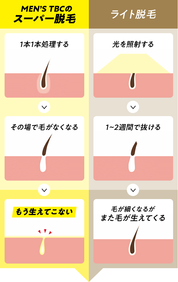 メンズTBCのヒゲ脱毛｜料金は高い?体験の口コミは悪い?脱毛効果や痛みも解説