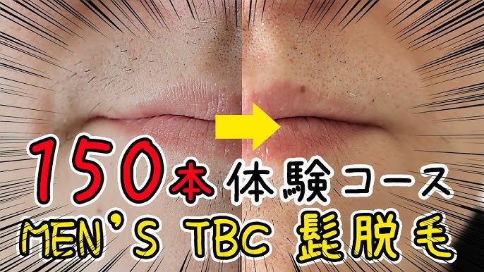 エステティックTBCの口コミ・評判！脱毛体験やボディシェイプ体験が超人気 | Beauty Park