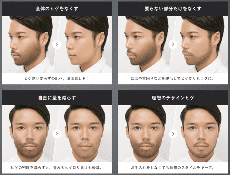 ヒゲ剃り楽々脱毛コース | メンズTBC