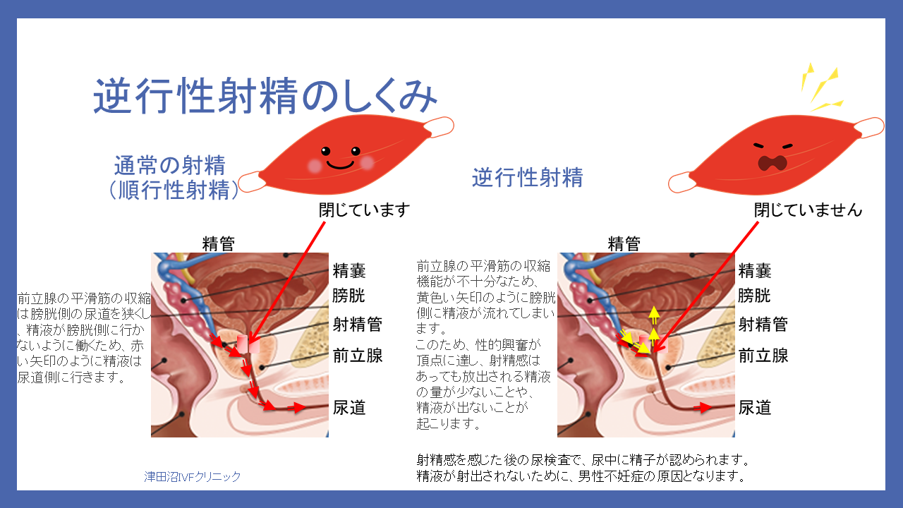 前立腺肥大症、男性更年期症、尿路結石症｜診療内容｜泌尿器科｜独立行政法人国立病院機構 京都医療センター