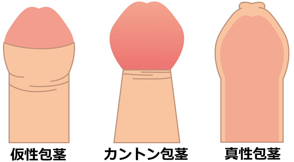 ムラムラじゃない！？朝勃ちの理由！男の仕組み・対応のコツ！ | リア女ニュース