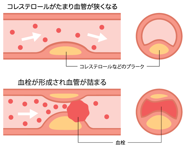 Dキャリアプラス | 口腔体操で誤嚥予防！正しいパタカラ体操の取り入れ方、効果的な嚥下トレーニングを紹介