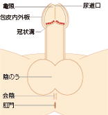 症例写真付】ペニスのねじれは修正可能！術後の痛みもほぼ無し！