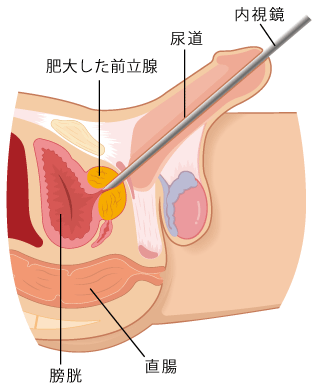 前立腺の探し方と！コツとアドバイス付き！【男の子宮】