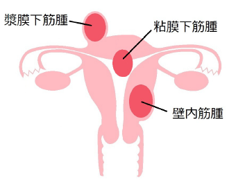 名器形成・膣縮小 | 診療案内 |