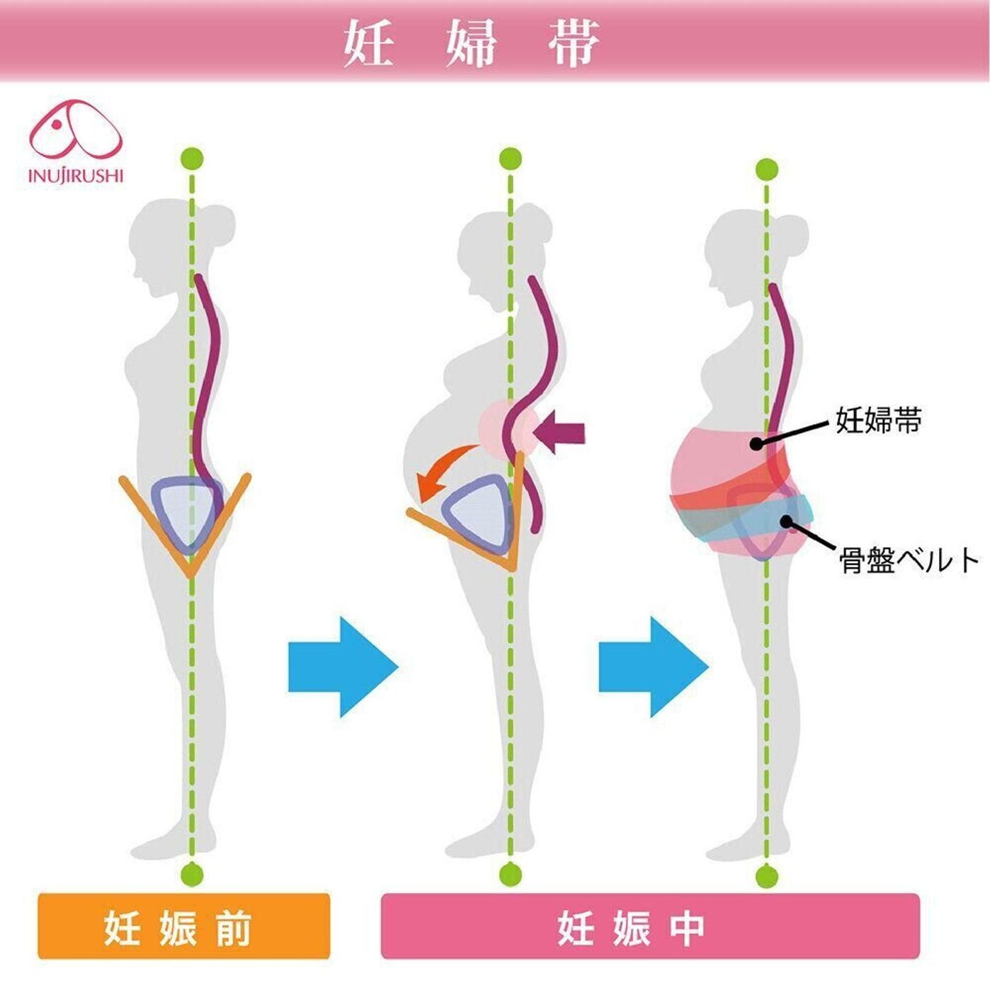 尾てい骨が出てる人の状態とは？生まれつきの原因と改善法を解説 | 生涯使える知恵袋