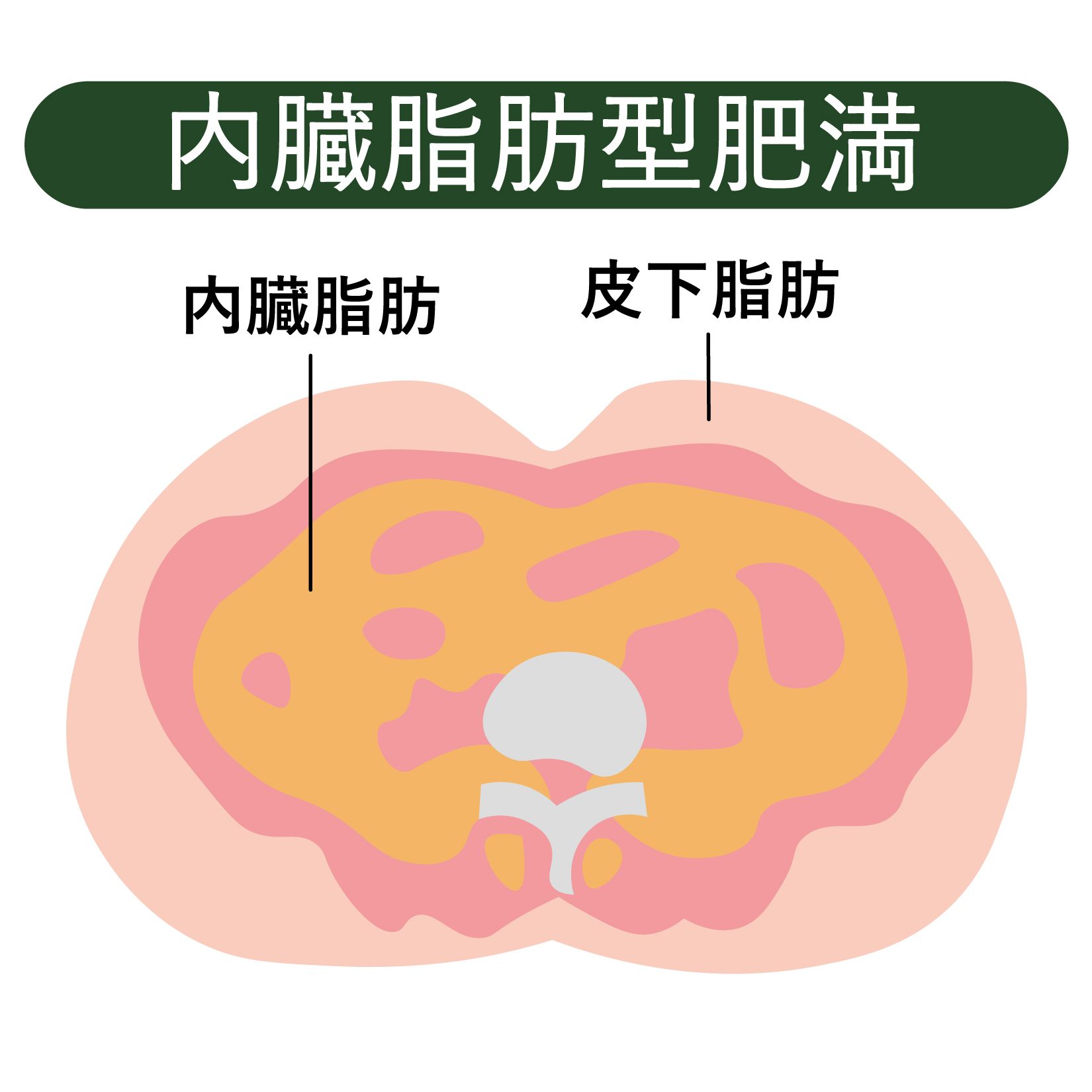 医師が解説】即効でお腹のガス抜きができる？対処法とおすすめの市販薬を紹介 – EPARKくすりの窓口コラム｜ヘルスケア情報