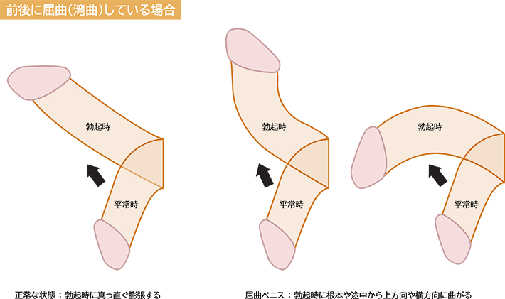 露茎を考察する ～大きさもね編～ | 西新宿杉江中央クリニック