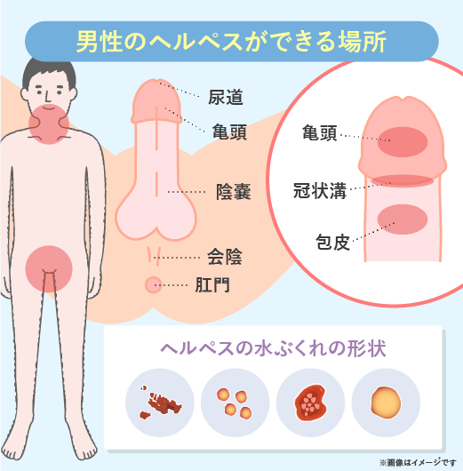 らくハピ アルコール除菌EX 詰め替え 400mL 1個