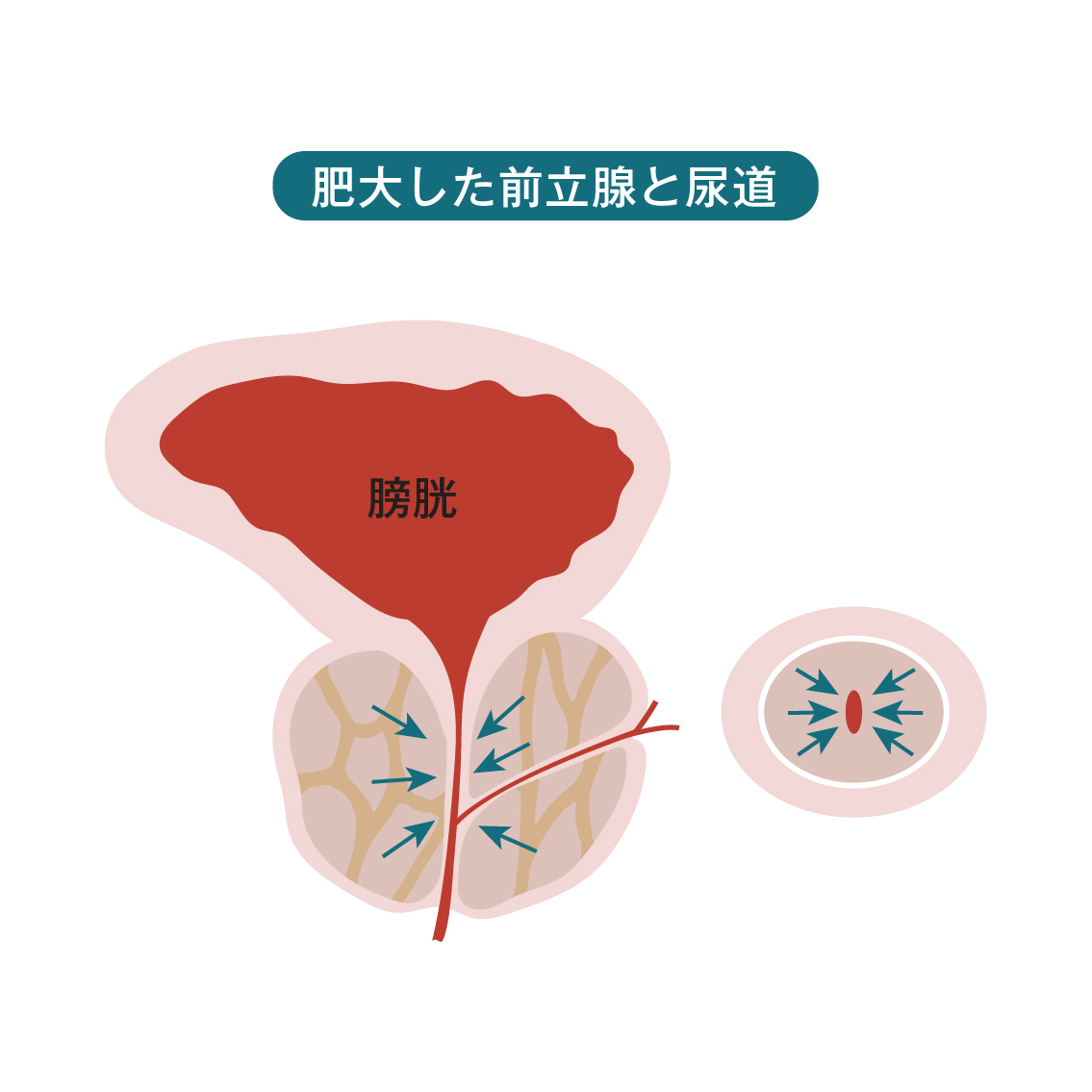 汚い画像ですみません。お風呂の排水溝から下水の匂いがしたので、パイプユニッシュ - Yahoo!知恵袋