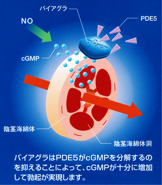 男性器（ペニス）が下向きや左右に曲がっている症状の修正治療例｜包茎・ED治療など男性形成なら銀座みゆき通り美容外科 東京銀座・大阪梅田