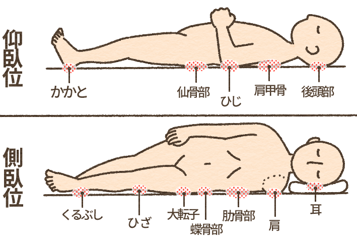 洗髪時、安楽な体位に気をつけるのはなぜ？｜清潔援助 | 看護roo![カンゴルー]