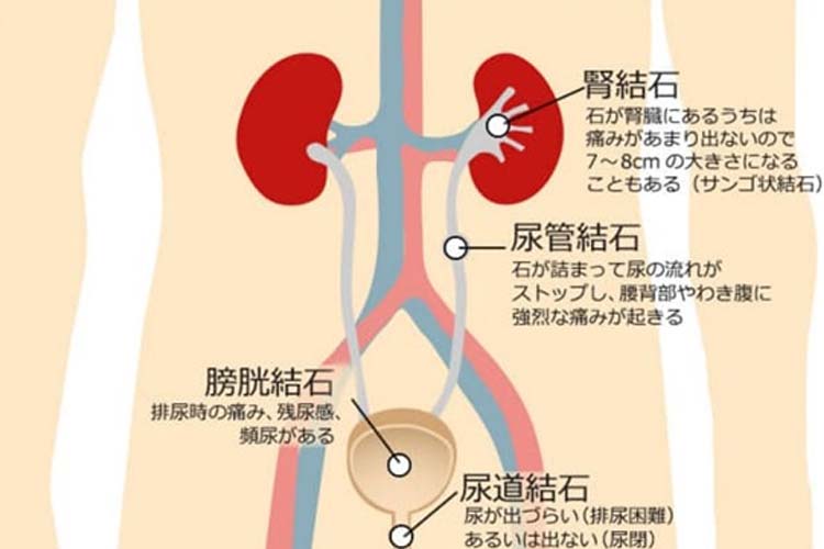 泌尿器科 男性 |