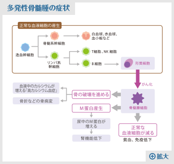 楽天ブックス: 多発性骨髄腫の診療指針2024 第6版