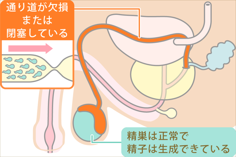 射精管理のやり方は？Hで最高潮の興奮を！ - 夜の保健室