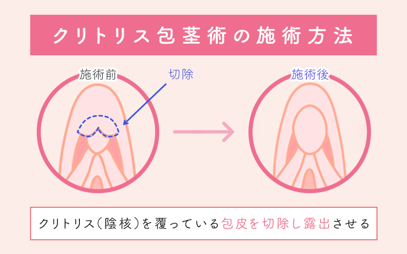 610)まんこ二毛作というワード -Noble-ノーブル--3|宮城のお店(ホスト-お店)-page - ホストラブ東北版