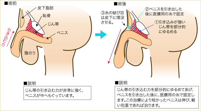 膣の長さや深さはどのくらい？構造を紹介 【医師監修】