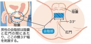 金粒【第2類医薬品】回春仙 85粒 心臓病 心悸亢進 盗汗