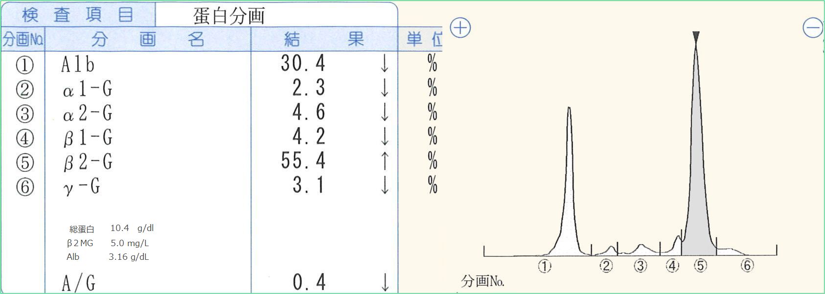 多発性骨髄腫は自分で気づくことができる病気なの？ #Shorts