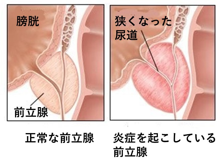 前立腺マッサージって効果あるらしい😊