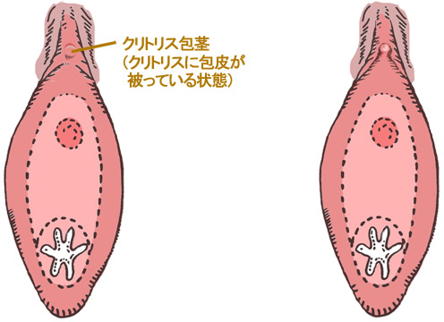 クリトリスの場所はどこ？構造・役割と快感を感じるためのいじり方 | Ray(レイ)