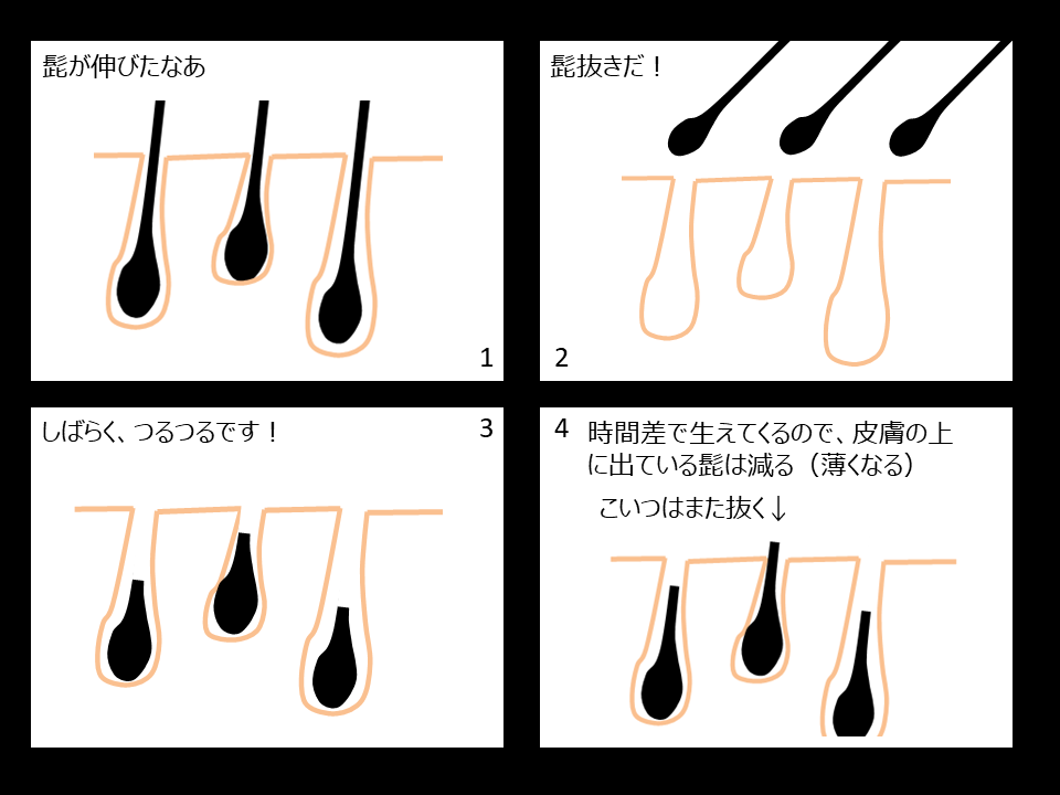 髭を抜くと生えなくなる?毛抜きのデメリットやおすすめのメンズ脱毛を紹介