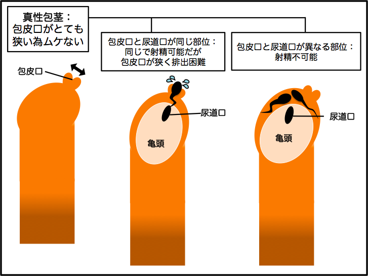 初体験】入らないって焦らなくても大丈夫？３つの対処法でお悩みを解決！ | arweb（アールウェブ）