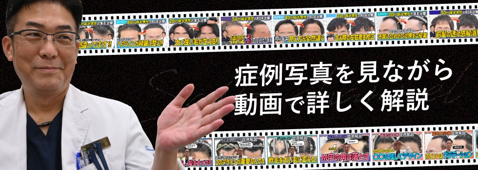 毛周期とは？脱毛との関係性や部位別の期間を知って、効果的に通おう！ | 新宿/渋谷/池袋の安い医療レーザー脱毛専門のビューティースキンクリニック