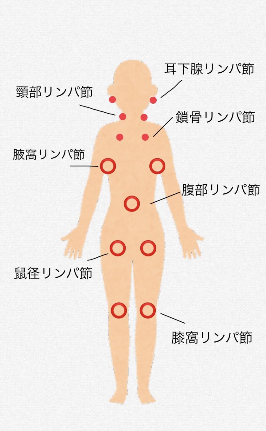 リンパマッサージのゴリゴリの正体とは？ゴリゴリの解消方法も紹介