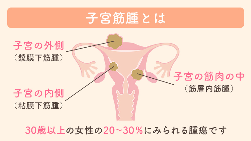 すんさんこんばんは。彼氏との行為中の悩みなのですが、モノが奥に当たると気持ちいいというより痛さが来てしまいます。 | Peing