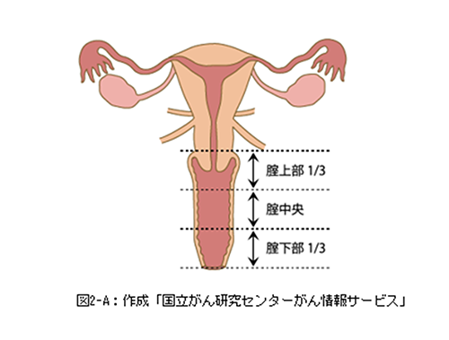 婦人科の病気｜婦人科｜三宅おおふくクリニック