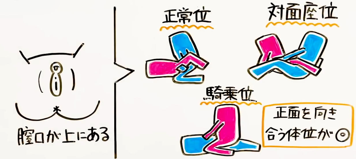 膣の上付き下付きの判別方法は？挿入のコツ - 夜の保健室