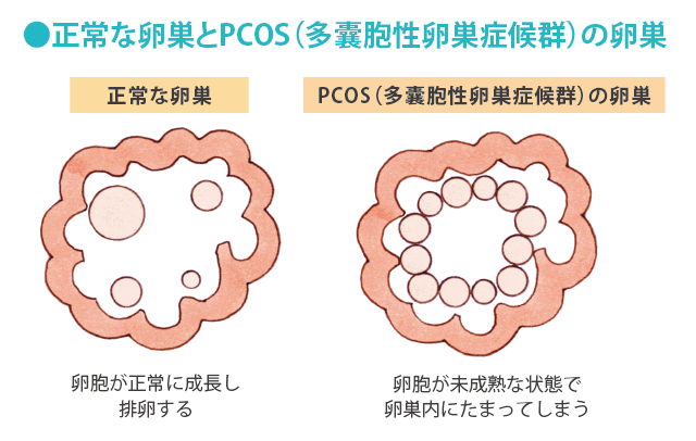 精子も３５歳から老化する。３５歳を過ぎてからの漢方対策 | 漢方専門 福田漢方薬局（大阪）