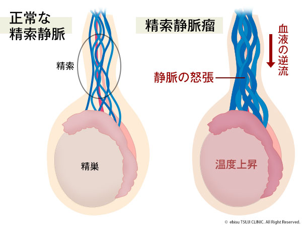 アナニーするとき前立腺と精嚢を勘違いして刺激していませんか？って話 | アネドラ