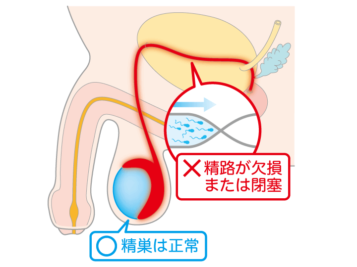 newTOKYO（ニュートーキョー） | 【医師に聞く】「好きな時に、好きなように射精すればいいじゃない」。夢精 についてアレコレ質問したら名言返ってきちゃった。