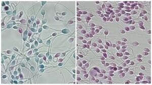 禁欲期間は短いほうが効果的！精子が満タンになるのは何日？【妊活男性必見】 | 妊活ならベビーライフ研究所