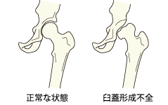 慢性副鼻腔炎(蓄膿症）日帰り手術｜【公式】 細田耳鼻科EAR CLINIC-大阪