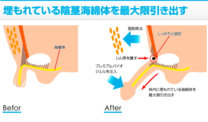 こんばんは、筋トレマニアで、アダルト評論家の一郎です。今日は、ペニスの大きさの測定方法（医学的計測）の話しです！ | 一郎の推奨 