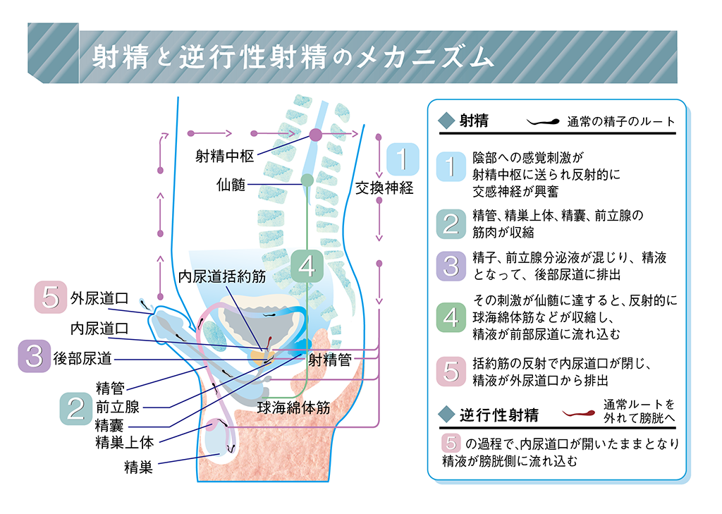 トイレに流してはいけない11の物