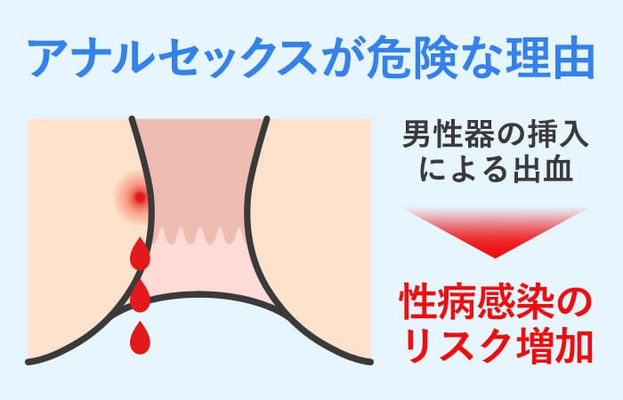 ケツ穴崩壊！超強力媚薬ガンギマリ「アナルSEX」 星川まい 通販｜セブンネットショッピング