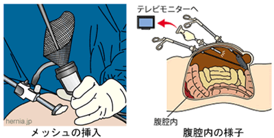 股関節が痛い原因は？病院か整体かどっちに行けばいいの？ | 伊集院整骨院