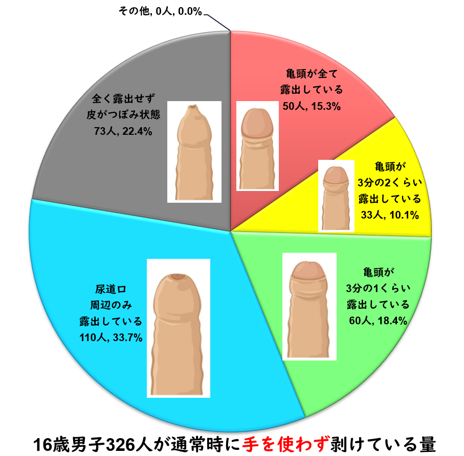 カントン包茎（嵌頓包茎）とは？手術と費用について｜MSクリニック