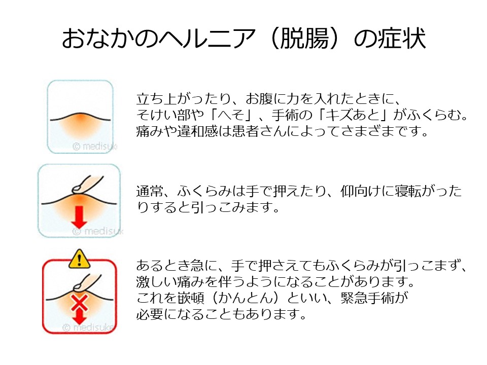 締め付けナシ！鼠径部解放 ふんどしショーツ 綿100% - 【LINGERIE