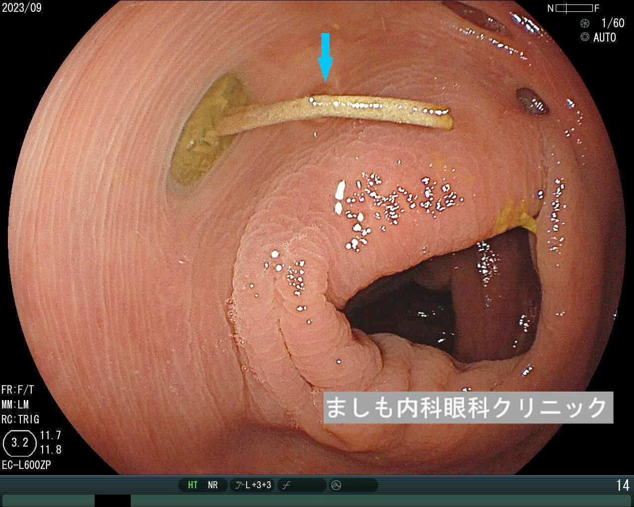 S状結腸を超えよう！ | 電マ好き