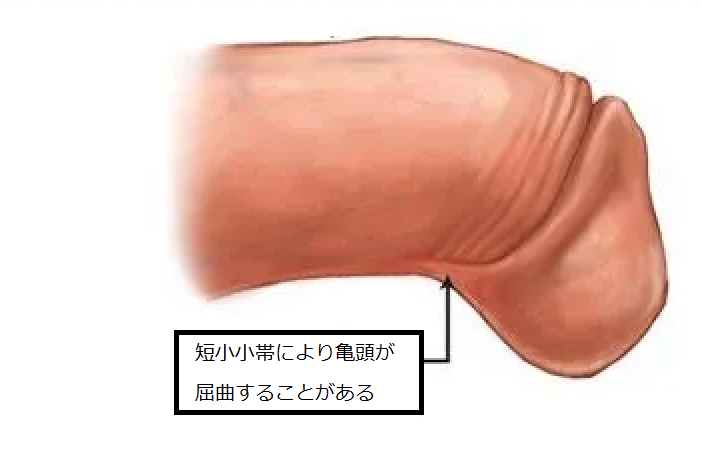 旦那のペニスが小さい？バレず着実にペニスを増大させる3つの方法を解説！ | ザヘルプM