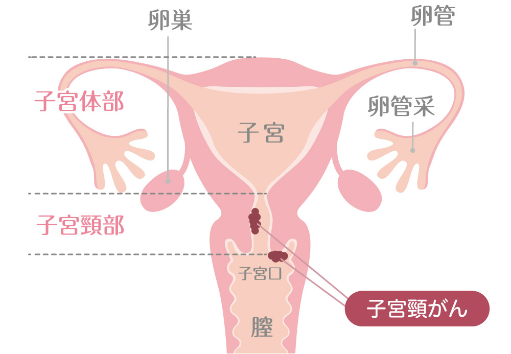 卵管閉塞ついて | 尼崎市の不妊治療なら妊娠率68.1％の技術を用いるミネモト鍼灸治療院