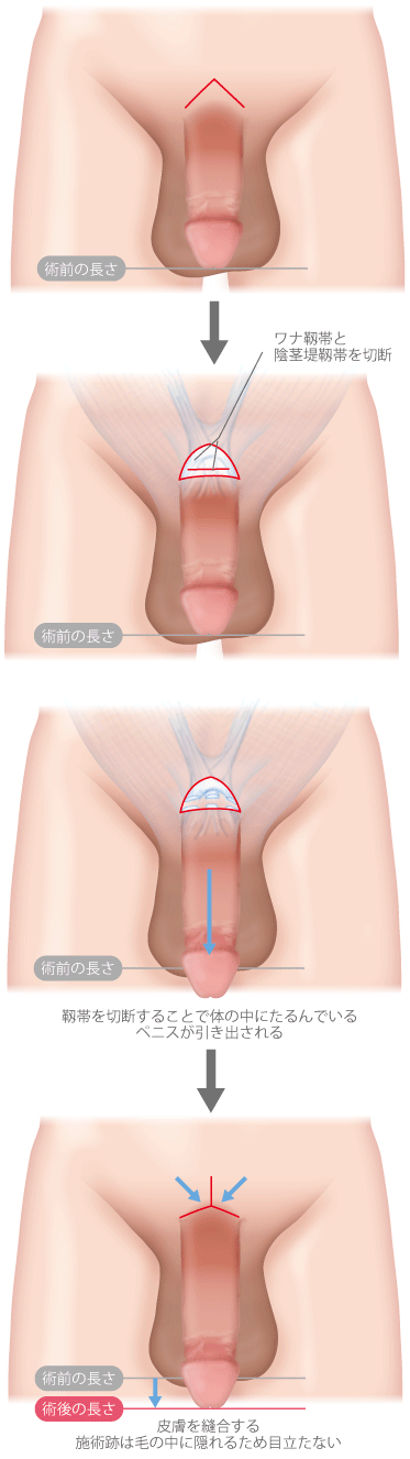 医師監修】【ペニスを硬くするために】たった1分！ほぐすだけで勃起力が上がる方法4選｜イースト駅前クリニックのED治療