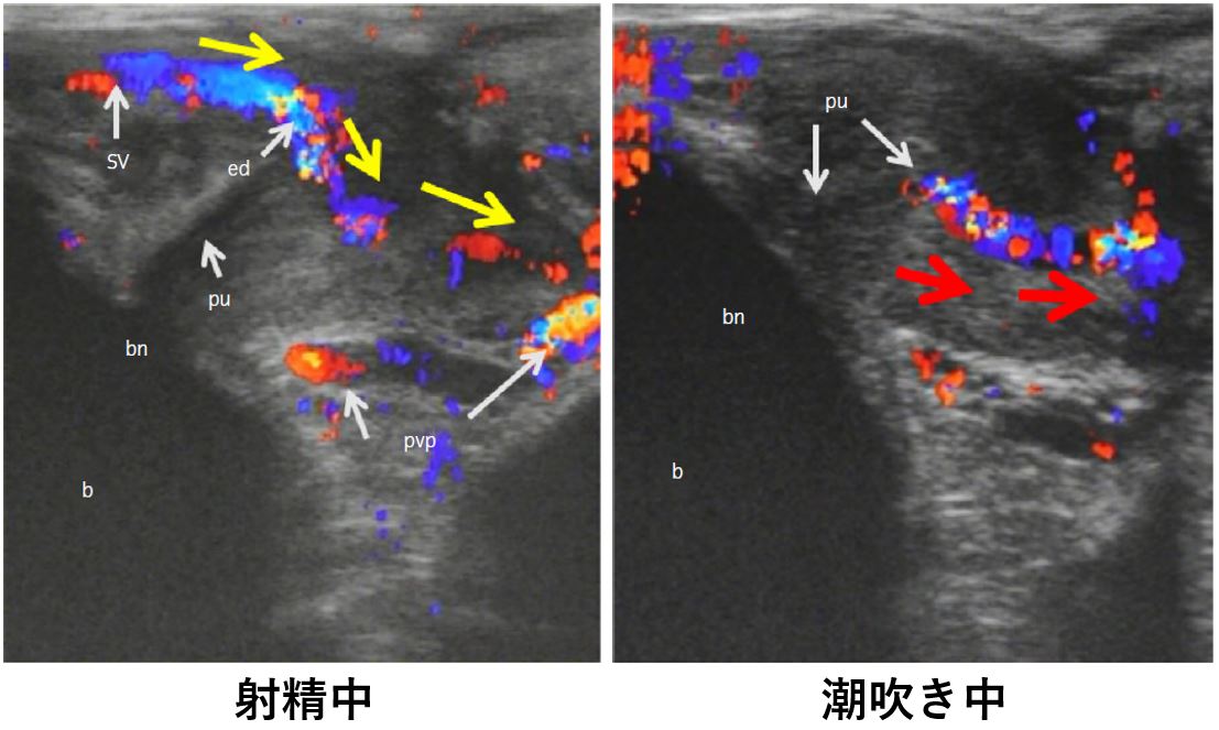 潮吹きさせる方法を徹底解説。潮を吹かせるには3つの条件が必要！